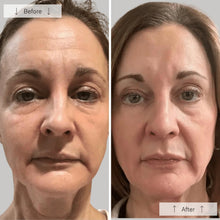 Load image into Gallery viewer, Omnilux Contour Face LED