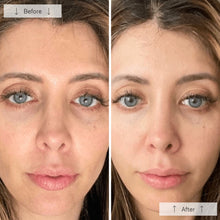 Load image into Gallery viewer, Omnilux Contour Face LED
